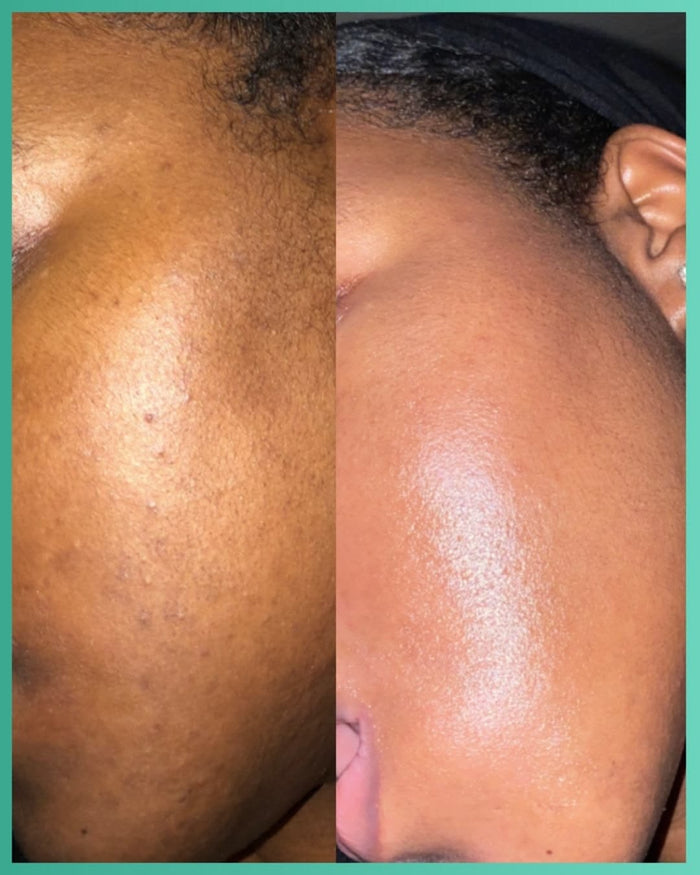 5 Days Booster Milk Serum – Complexion Refining & Hydrating Serum