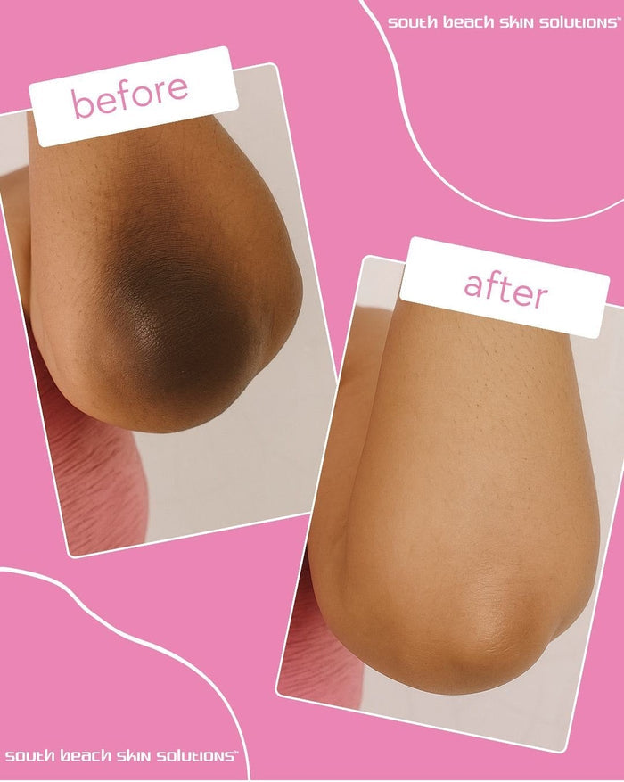 5 Days Booster Milk Serum – Complexion Refining & Hydrating Serum