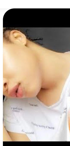Active Caviar Drip Kojie San Serum (1 Bottle)