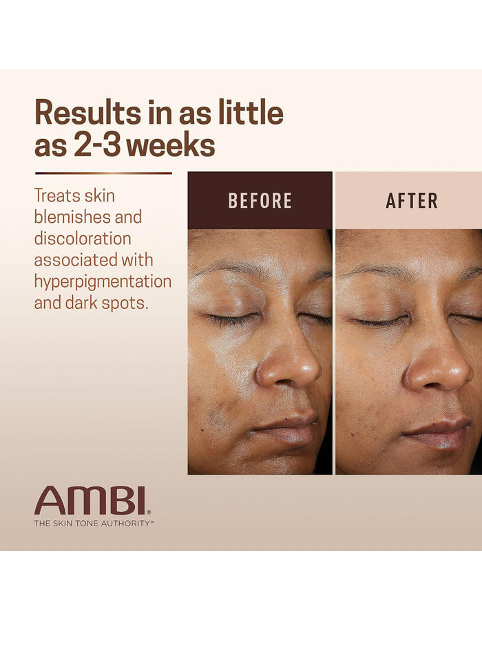 AMBI® Even & Clear Fade Cream – Dark Spot & Uneven Tone Moisturizing Cream